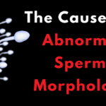 Sometimes, sperm can be abnormal due to environmental factors such as radiation exposure or chemicals found in paints and other products.